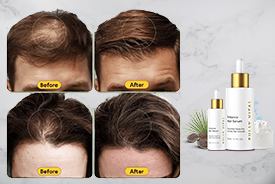 FullyVital Hair Serum